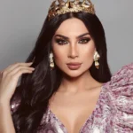 Glow Radiant Hazelnut - Premium Colored Contact Lenses | Optical Plaza